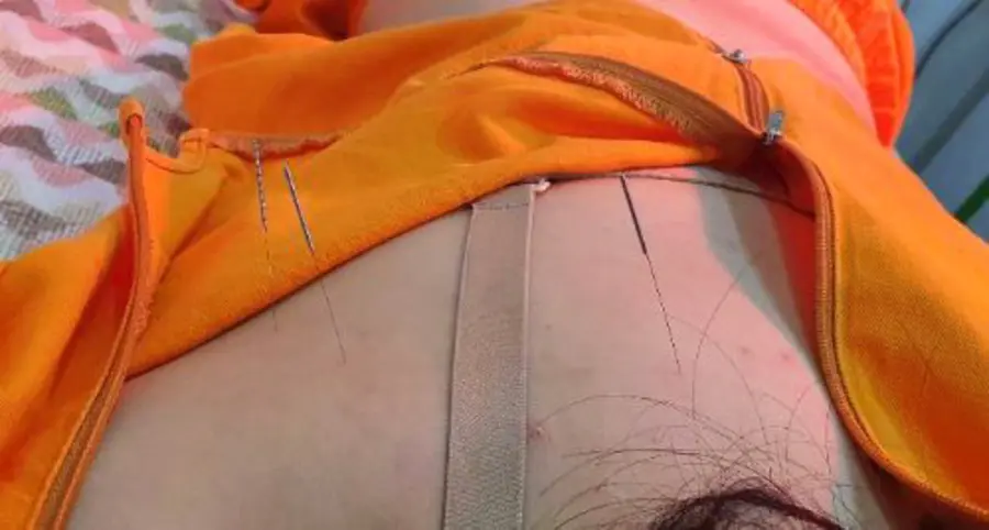 침 치료 모습